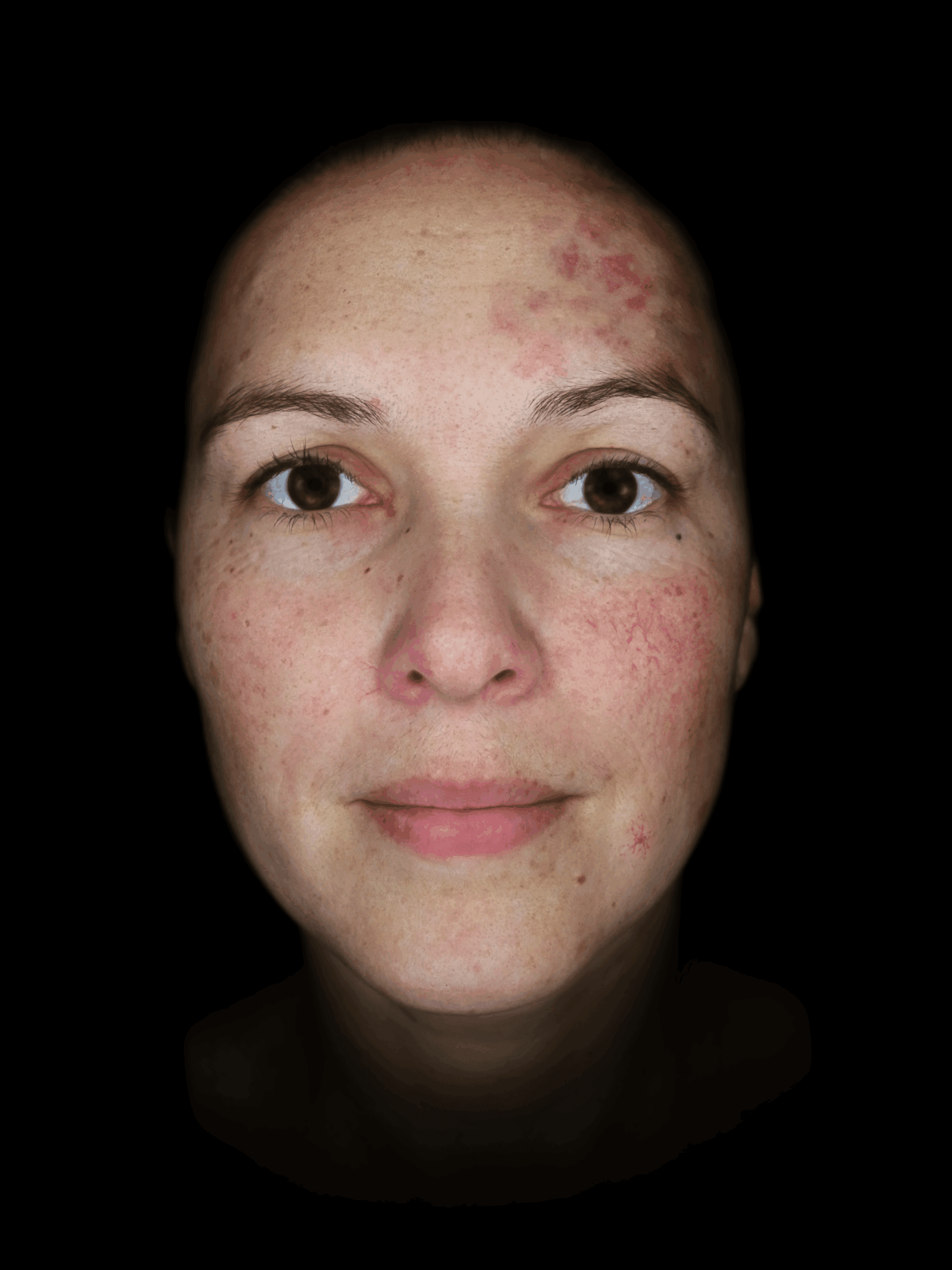 observ_qrc_520x_2020-model_cross