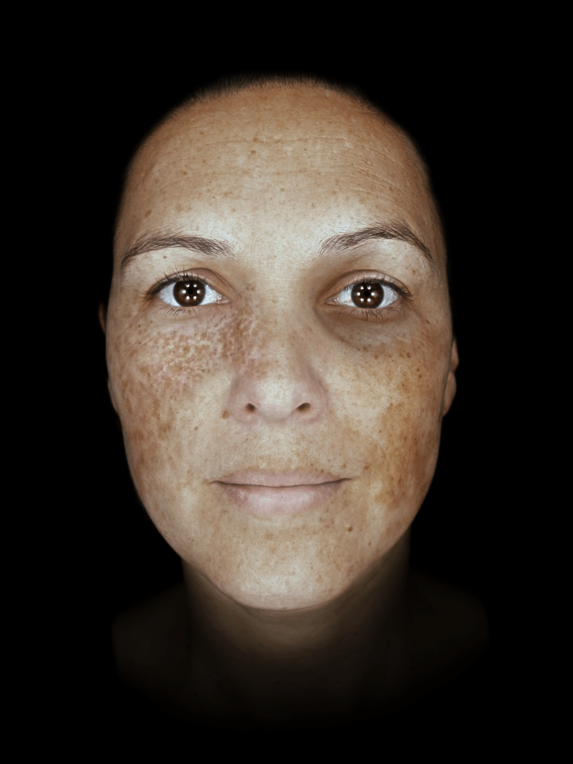 observ_qrc_520x_2020-model_pigmentation