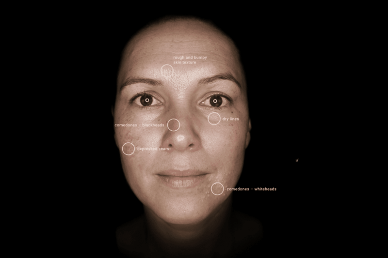 parallel-polarisation