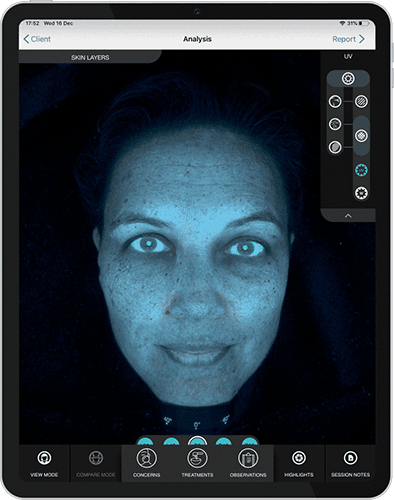 sylton_website_520-productpage-analysemodi-uv-394×500