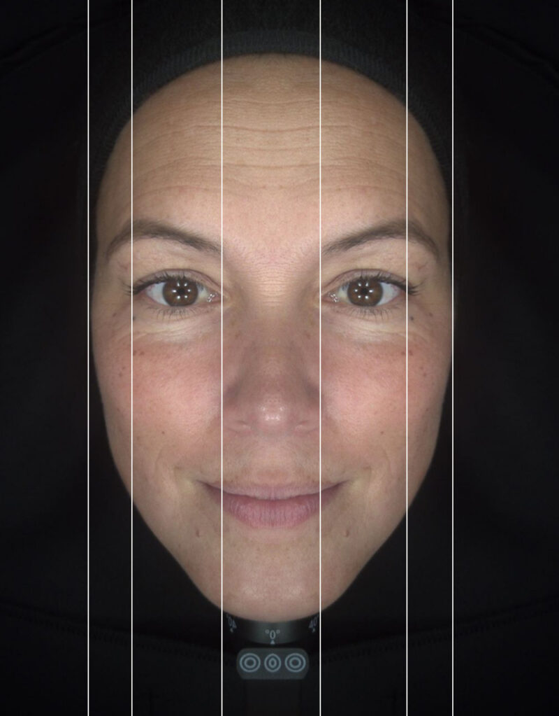 facial harmony