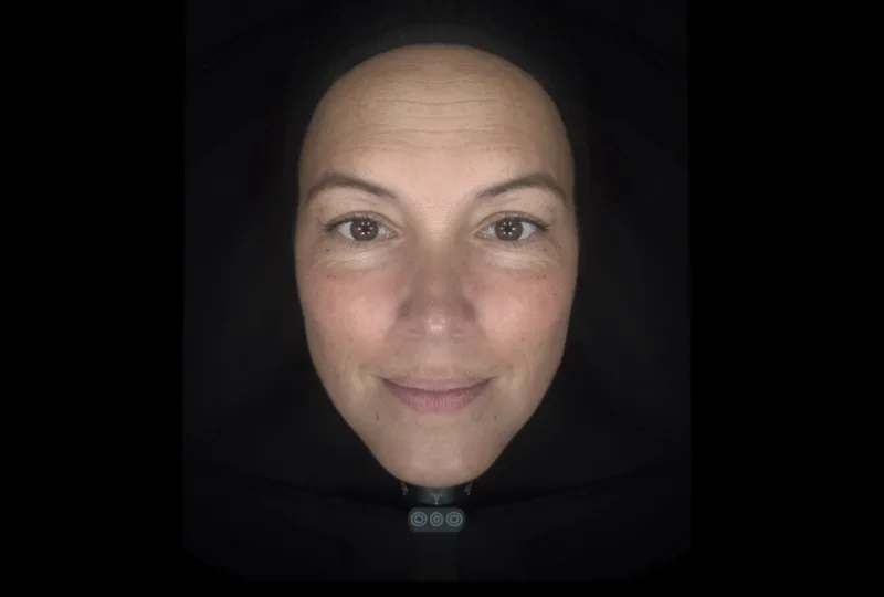 facial-symmetry-rr