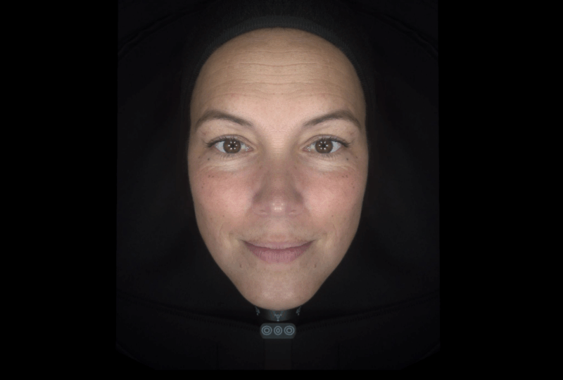 facial symmetry rr