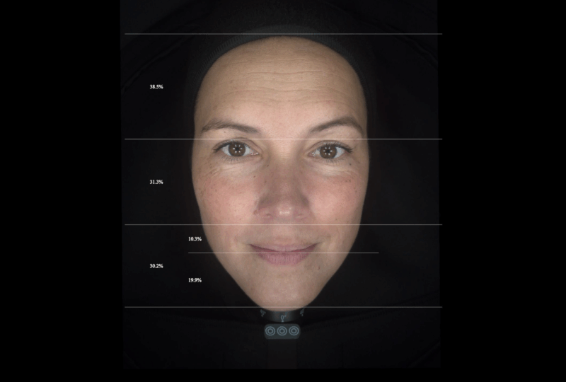 facial thirds