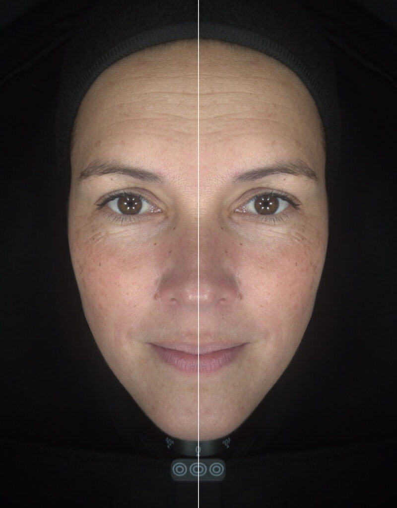 facial symmetry 2